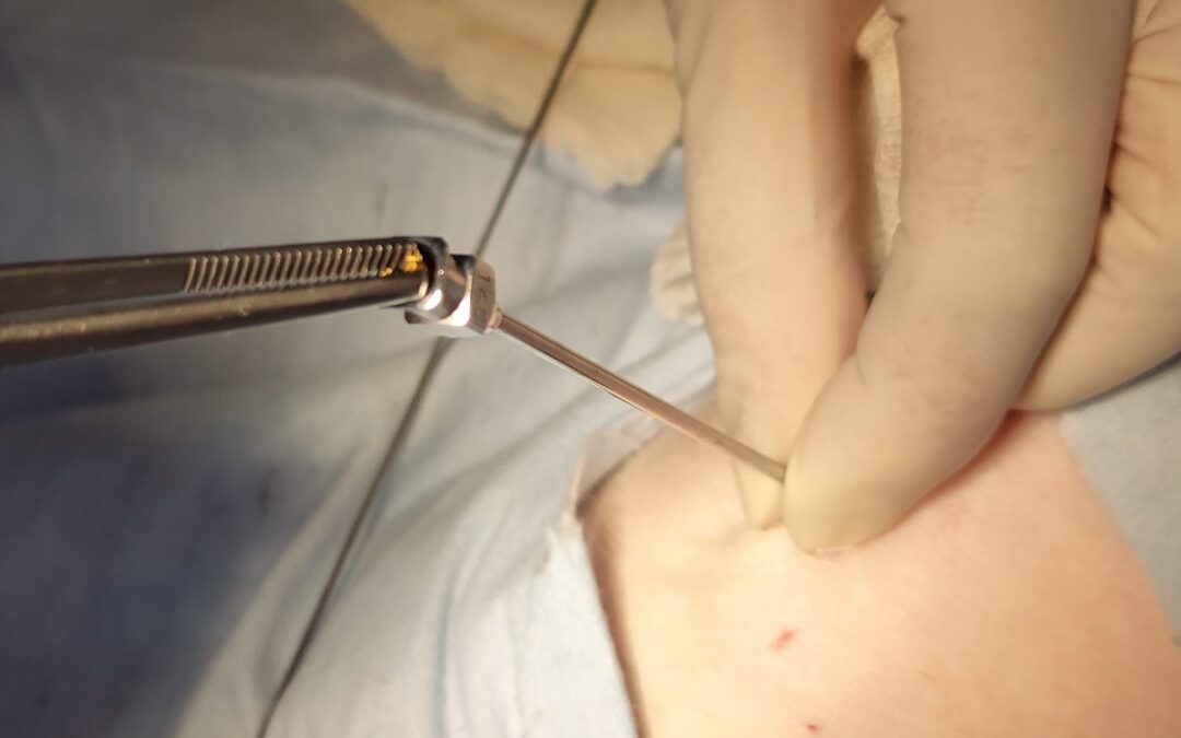 Gold Implant